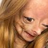 Adalia Rose